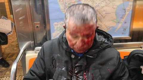 A subway passenger after he was assaulted on Friday.