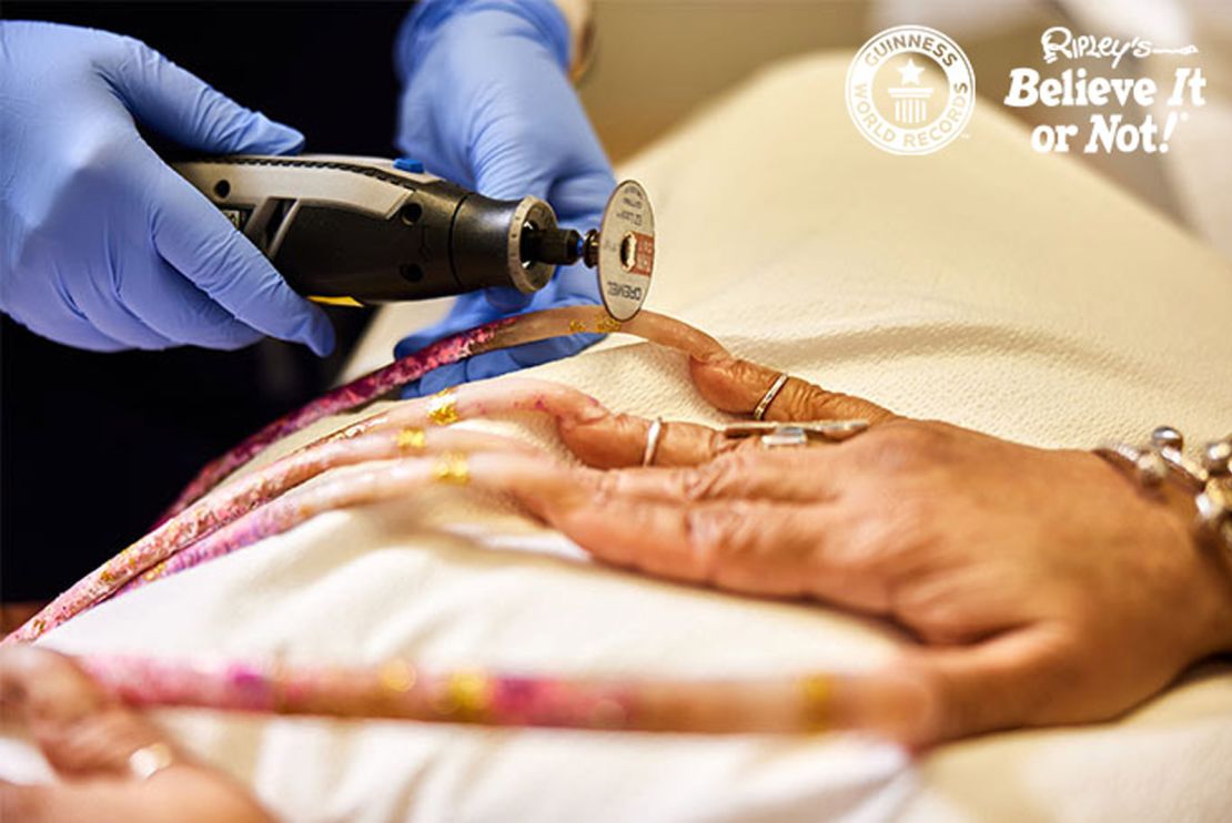 Trinity Vista Dermatology used an electric rotary tool to cut the record-breaking nails.
