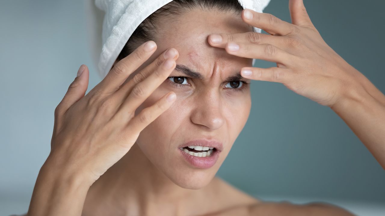 Woman looking at pimple