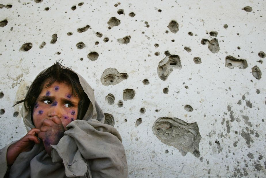 Mohboba, 7, stands near a bullet-ridden wall in Kabul as she waits to be seen at a health clinic in March 2002. She had a skin ailment that plagued many <a href="https://www.cnn.com/2016/05/31/middleeast/cnnphotos-afghanistan-between-hope-and-fear" target="_blank">poverty-stricken children in Afghanistan.</a>
