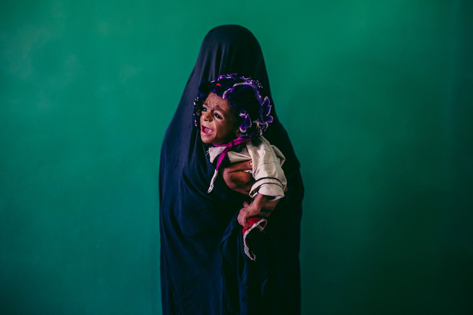 Samiullah, 8 months old and malnourished, is held by his mother, Islam Bibi, at a Doctors Without Borders hospital in Lashgar Gar, Afghanistan, in September 2013.