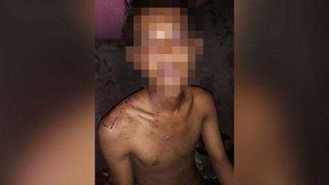 The 19-year-old said he was repeatedly beaten while held in military detention. 