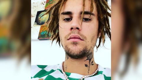 Justin Bieber debuted dreadlocks Monday in an Instagram post.