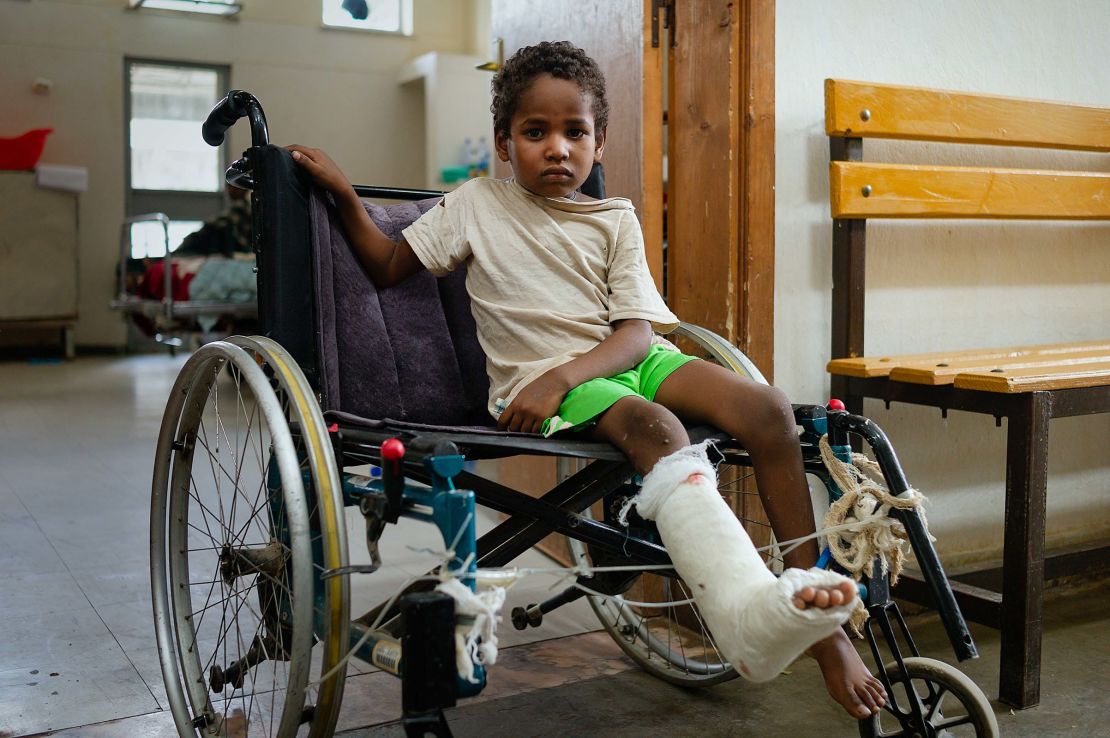 Hannibal, 7, is treated at Axum Teaching and Referral Hospital for a gunshot wound to the leg, which he received from soldiers' gunfire as he was sitting on his mother's lap.