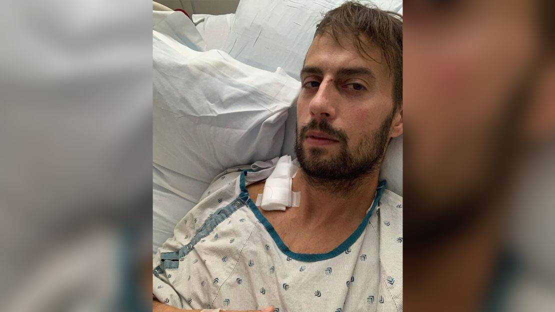 Ryan Fischer was shot while walking Lady Gaga's dogs.