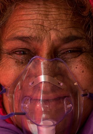 An elderly woman wears an oxygen mask that was provided at a Sikh temple, also known as a gurdwara, in New Delhi.