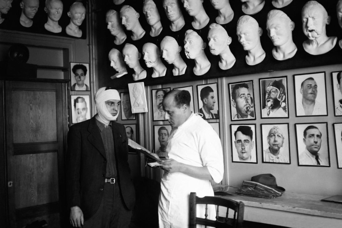 A doctor examines a patient at the maxillofacial Center of Marie Lannelongue Hospital in Paris. Headed by doctor Maurice Virenque, the hospital has been a pioneer of reconstructive surgery in the 20th century.