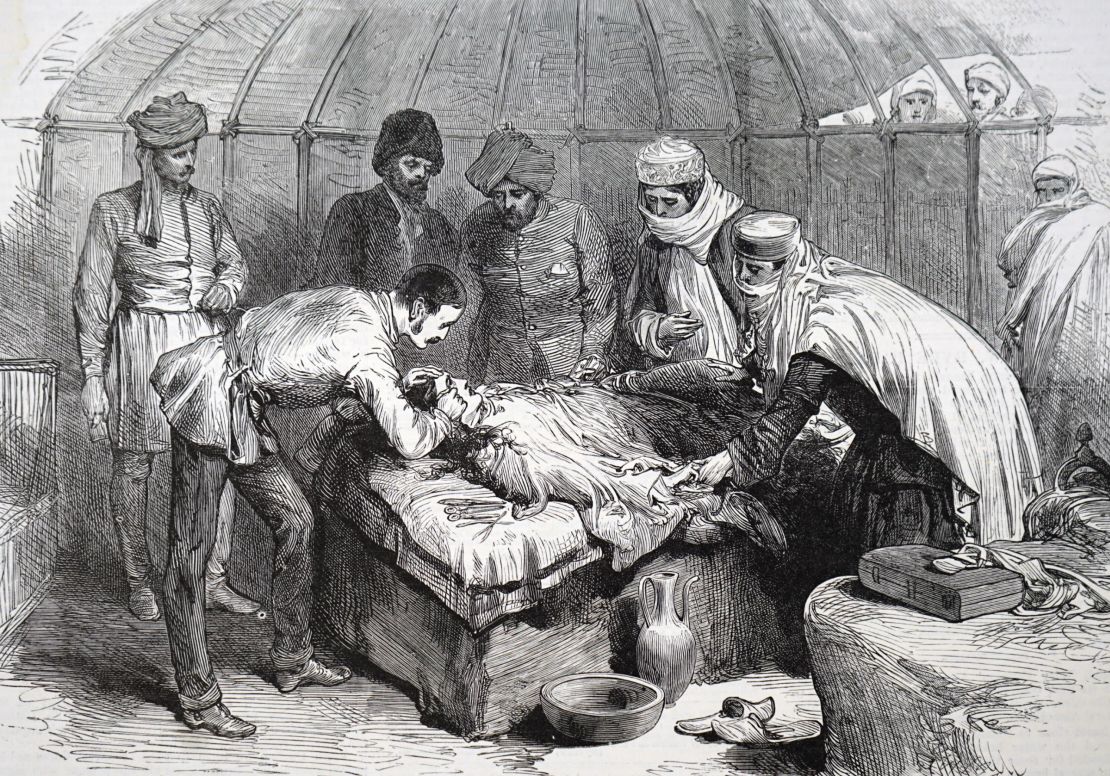 An illustration depicting 19th-century plastic surgery being performed on a woman with facial burns.