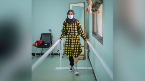 Weam Elastal learning how to use her new prosthetic leg.