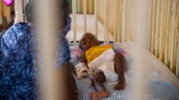 Marie Rose Emile watches over her 6-month-old grandson Jonise as he is treated for malnutrition at the Hospital of Immaculate Conception, in Les Cayes, Haiti, Wednesday, May 26, 2021. UNICEF's regional director for Latin America and the Caribbean visited the  southern seaport amid concerns over an increase in malnutrition and a drop in childhood immunizations that officials blame on the coronavirus pandemic. (AP Photo/Joseph Odelyn)
