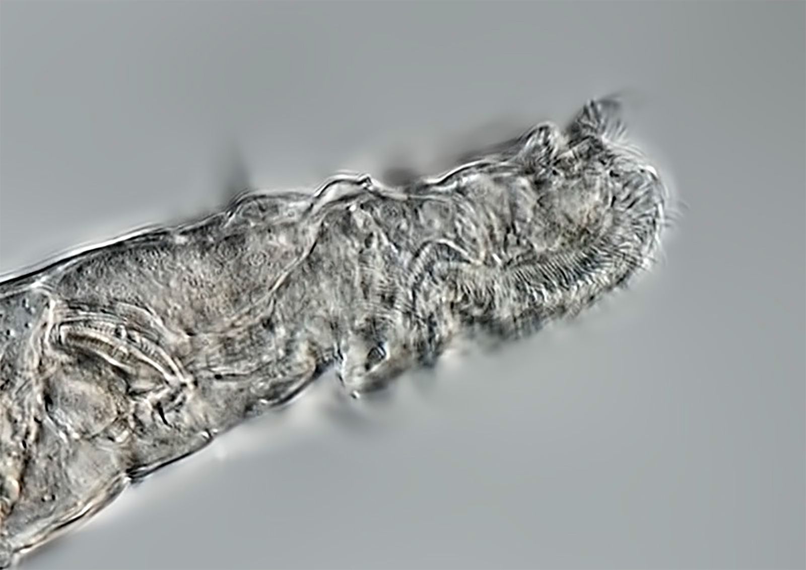 rotifer under a microscope