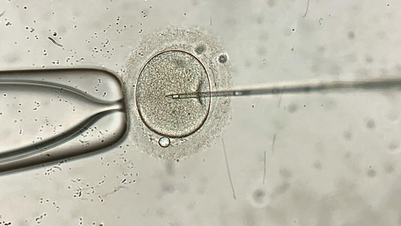 Remarkable macro view through the microscope at process of the in vitro fertilization of a female egg inside IVF dish in the laboratory. Horizontal.