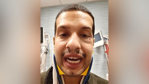 San Francisco Uber driver Lucas Chamberlain shows the injuries he received after an argument with a patron turned violent on March 15, 2020.