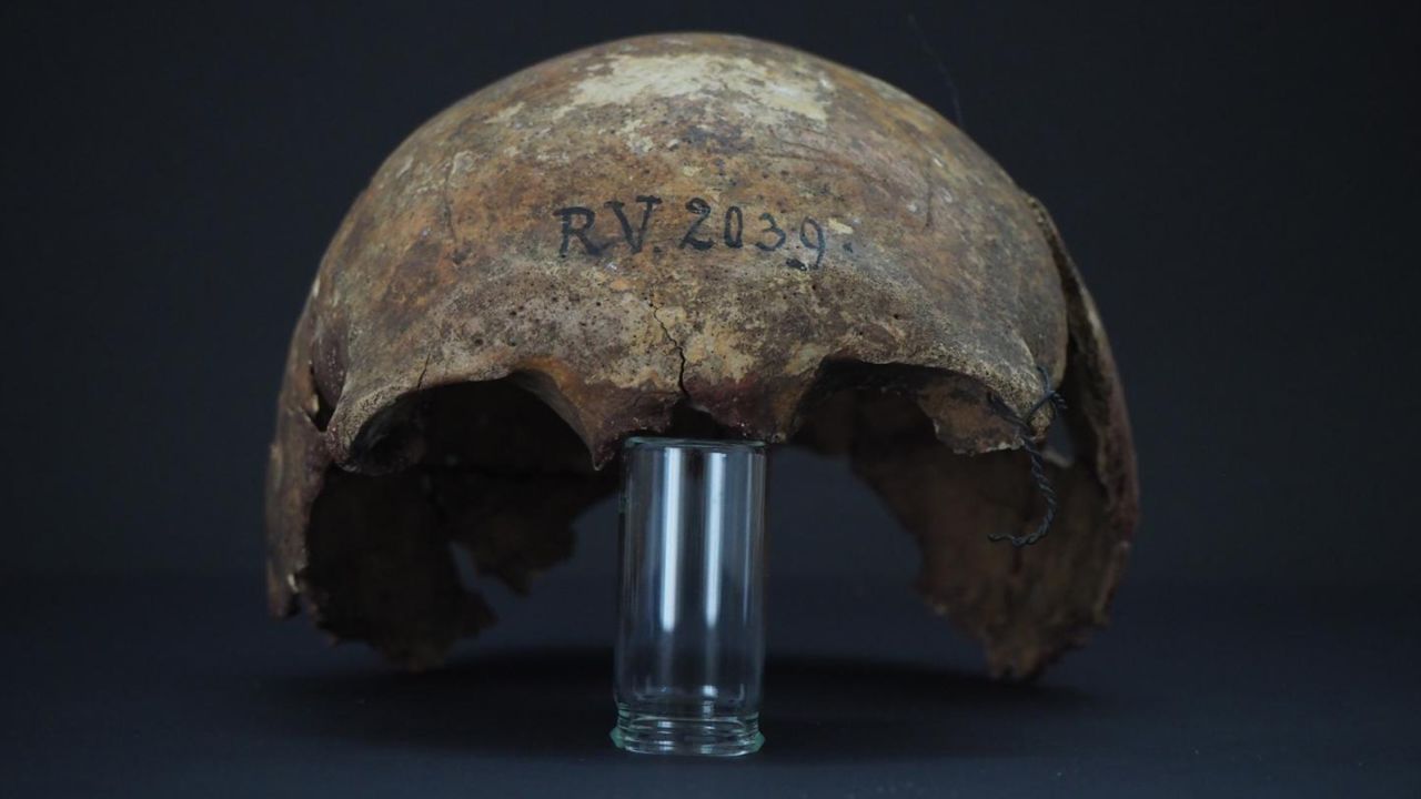 The skull of the man buried in Riņņukalns, Latvia, around 5,000 years ago.