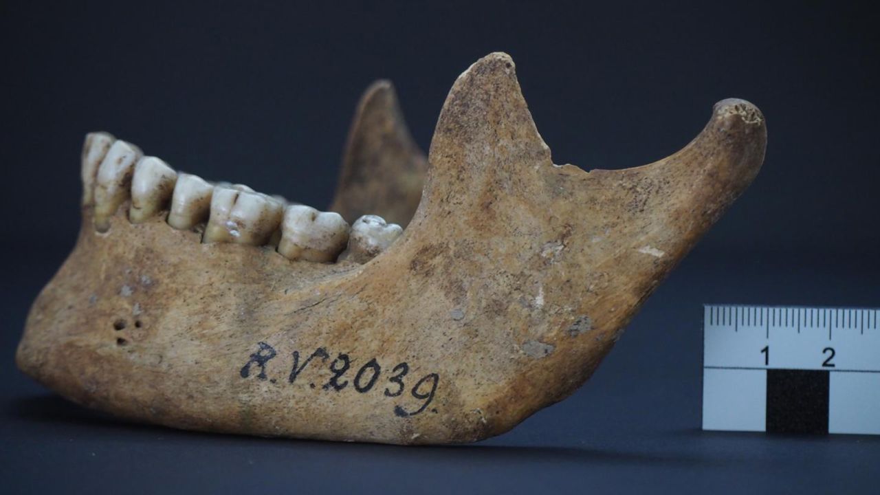 The jawbone of the man who was buried in Rinnukalns, Latvia, around 5,000 years ago.