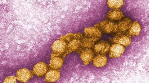 An electron micrograph of the West Nile virus. New York City reported two human cases of the virus Tuesday.