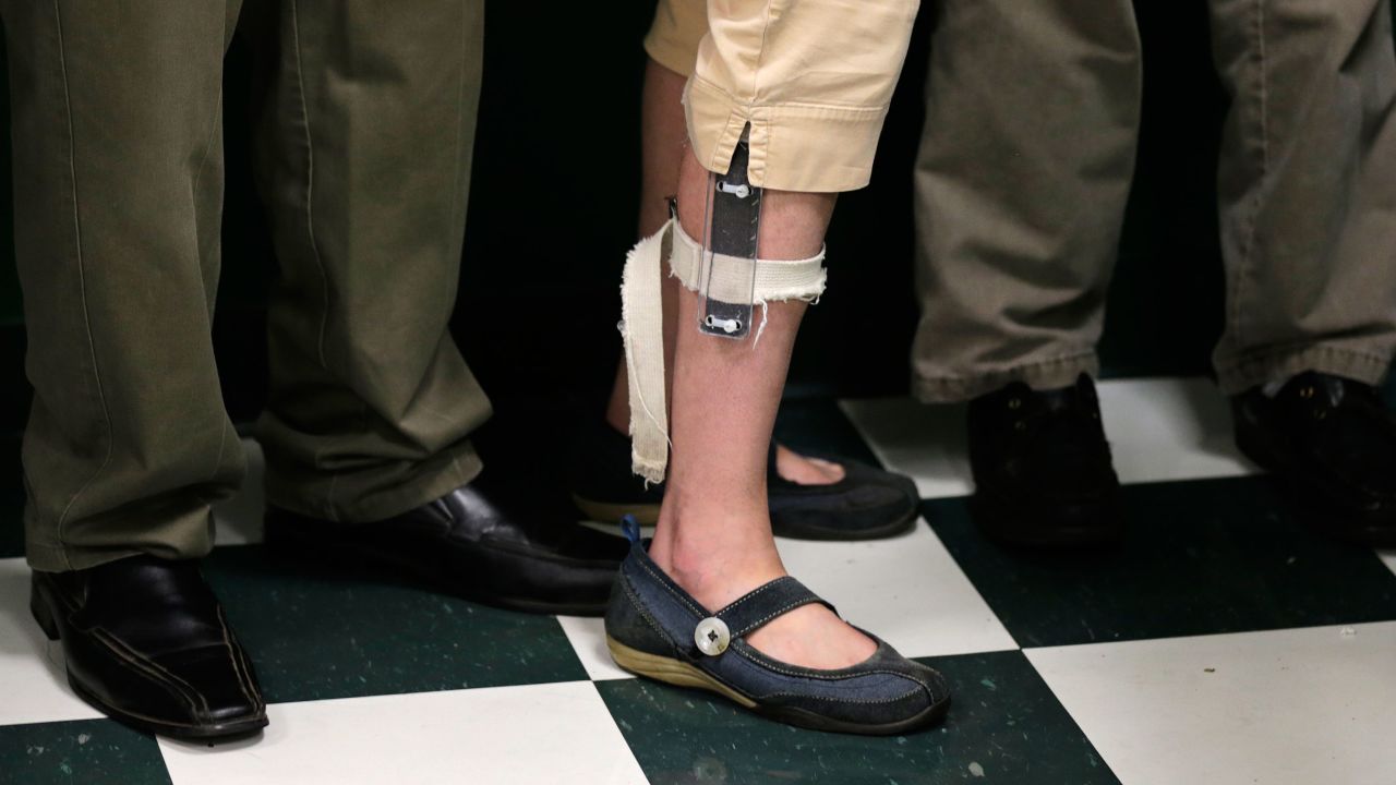 A student wearing an electrical shocker device on her leg lines up with classmates after lunch at the Judge Rotenberg Educational Center in Canton, Massachusetts, on August 13, 2014. 