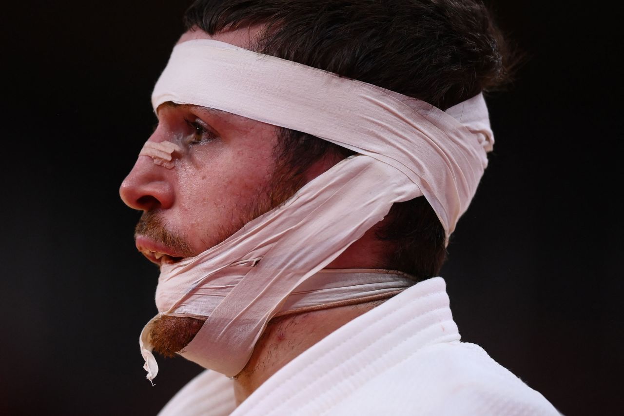 Spanish judoka Alberto Gaitero Martin is bandaged during his bout against Ukraine's Georgii Zantaraia on July 25.