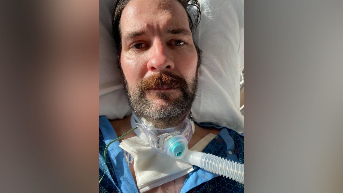 Terry Greear's iconic beard was shaved in the hospital. He lost 50 pounds.
