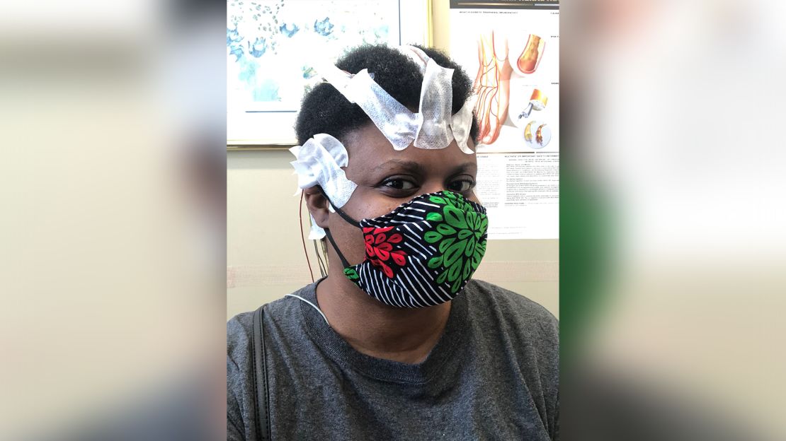 Chimére L. Smith has been struggling with long Covid since she was sick in March 2020. She underwent numerous neurologic tests, including electroencephalogram, to evaluate her problems with short-term memory, mobility and vision.