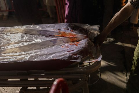 A bloodied gurney is seen at a Kabul hospital on Thursday.