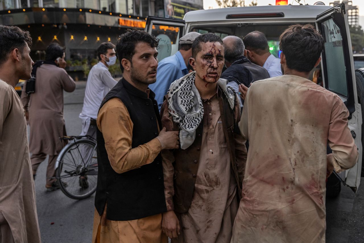 An injured man is seen outside a hospital after Thursday's attack.