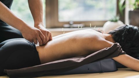 Acupuncture, a traditional Chinese medicine practice, is now used around the globe as a complementary therapy for pain relief.