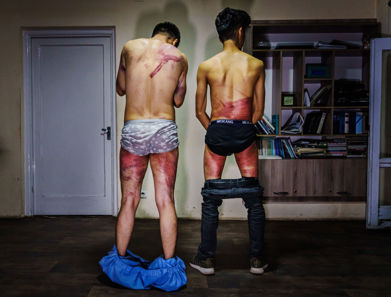 Journalists from Afghanistan's Etilaatroz newspaper — video journalist Nemat Naqdi, left, and video editor Taqi Daryabi — undress to show wounds they sustained after Taliban fighters tortured and beat them while in custody. They had been arrested while reporting on a <a href="https://www.cnn.com/2021/09/08/asia/afghanistan-women-taliban-government-intl/index.html" target="_blank">women's rights protest in Kabul</a> on Wednesday, September 8. 
