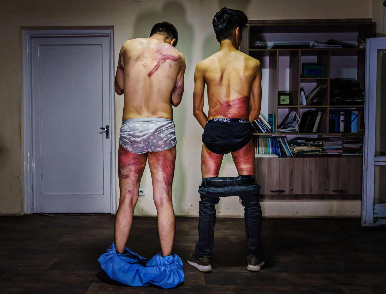 Journalists from Afghanistan's Etilaatroz newspaper — video journalist Nemat Naqdi, left, and video editor Taqi Daryabi — undress to show wounds they sustained after Taliban fighters tortured and beat them while in custody. They had been arrested while reporting on a <a href="https://www.cnn.com/2021/09/08/asia/afghanistan-women-taliban-government-intl/index.html" target="_blank">women's rights protest in Kabul</a> on Wednesday, September 8.