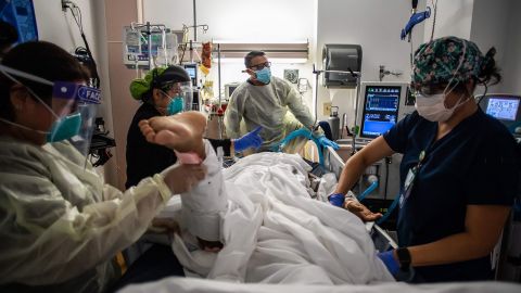Health care workers attend to a patient with Covid-19 at the Cardiovascular Intensive Care Unit at Providence Cedars-Sinai Tarzana Medical Center in Tarzana, California.