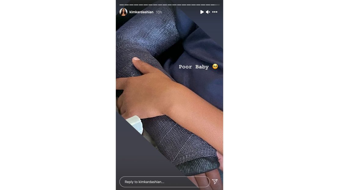 Kardashian's Instagram Story showed Saint's arm in a cast.