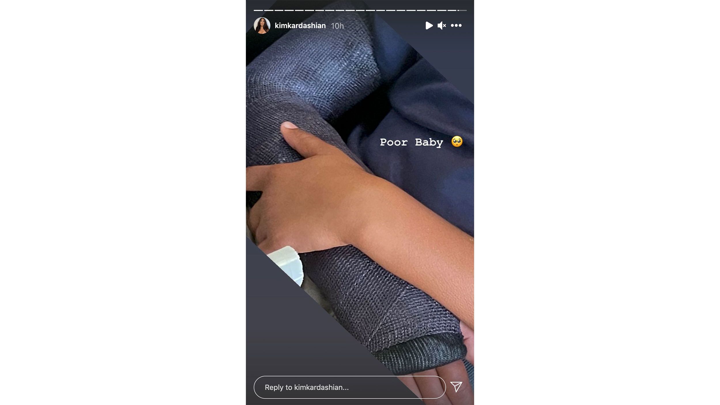 Kardashian's Instagram Story showed Saint's arm in a cast.