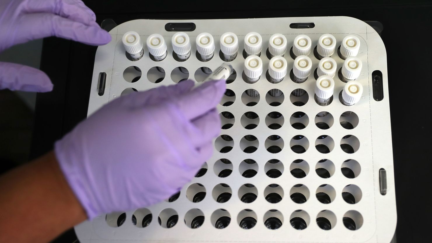 A Boston University staff member helps arrange returned COVID-19 test swabs from students, staff and others at the university's COVID testing collection kiosk on campus on Aug. 26, 2021.