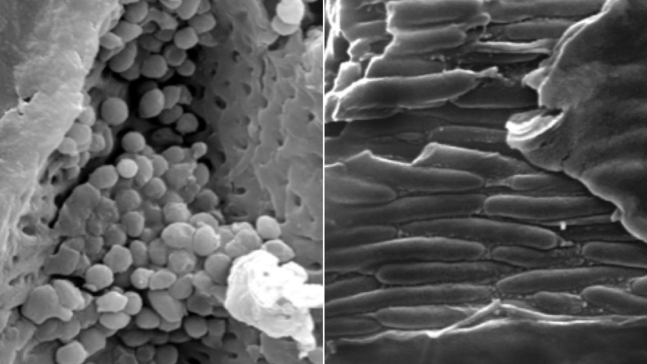 On the left are "meatball" shaped melansomes -- structures that correspond with ginger or reddish brown pigment. On the right, are "sausage shaped" melansomes that correspond with black pigment.