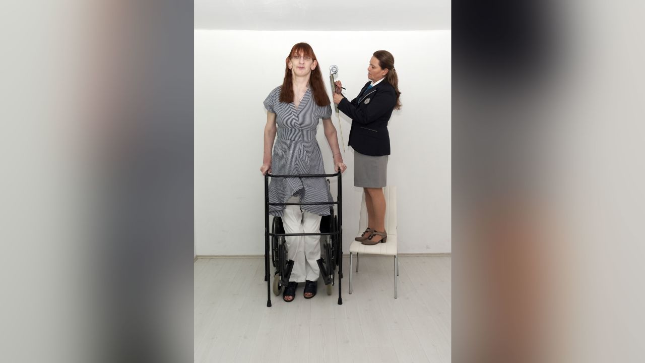 Gelgi normally uses a wheelchair, but she can move using a walker for short period.