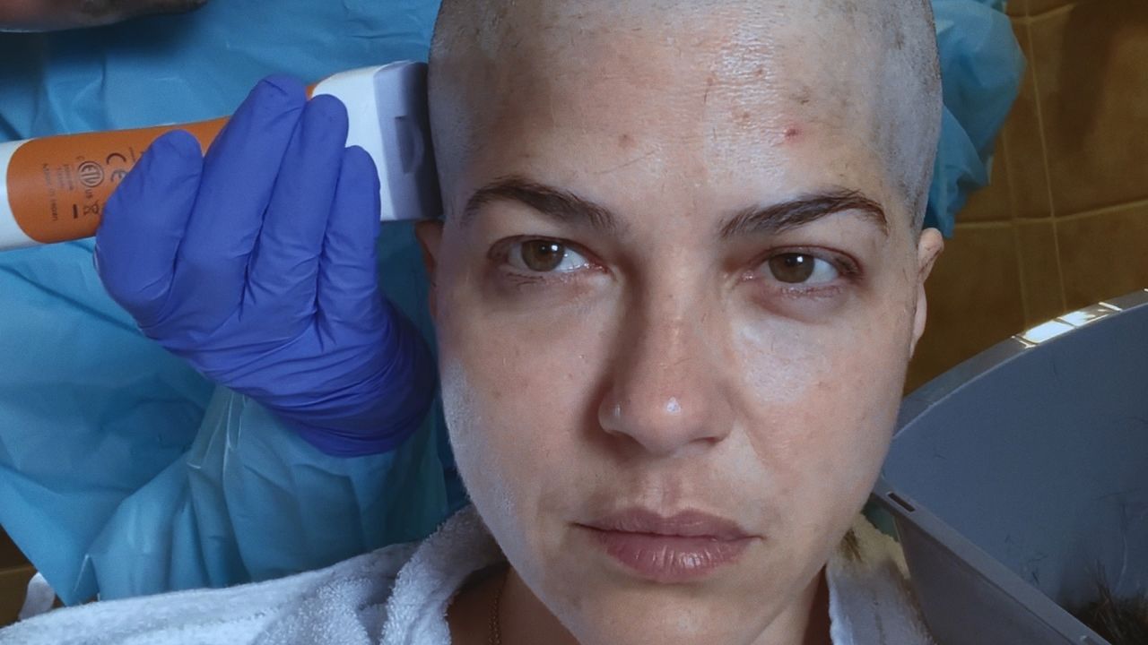 Selma Blair is shown receiving stem-cell treatment in the documentary 'Introducing, Selma Blair.'