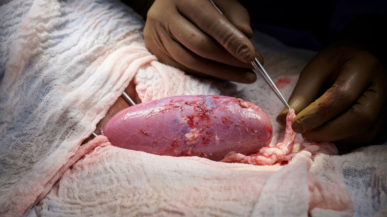 The successful experiment should allow for trials in patients with end-stage kidney failure.