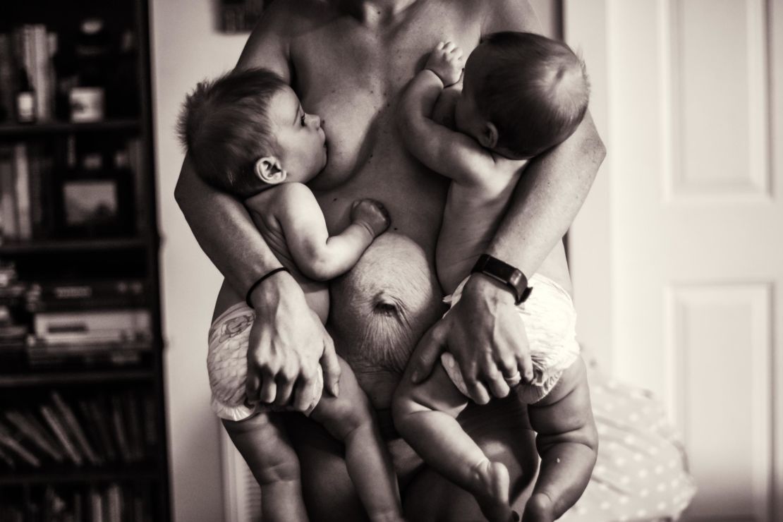 Life after birth': Intimate photos show postpartum journeys of