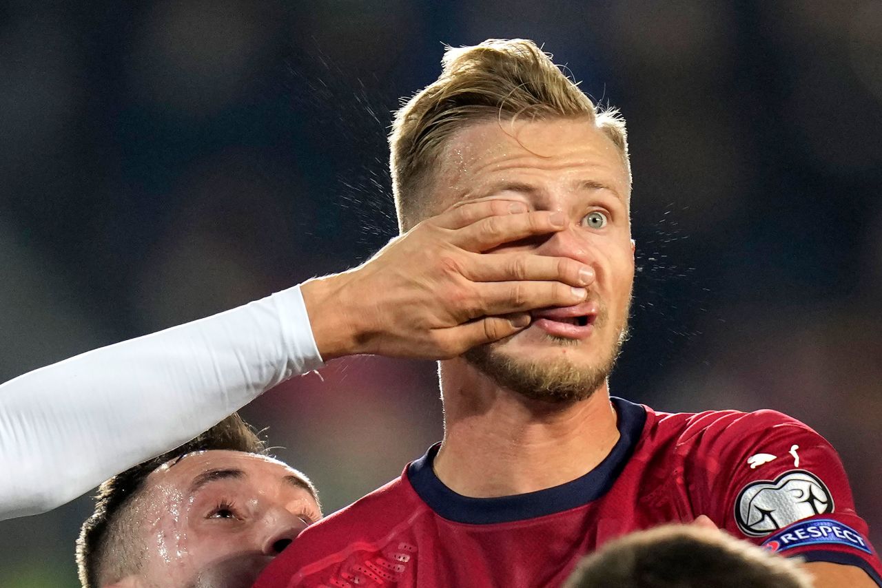 Czech soccer player Antonín Barák is hit in the face during a World Cup qualifier against Estonia on Tuesday, November 16.