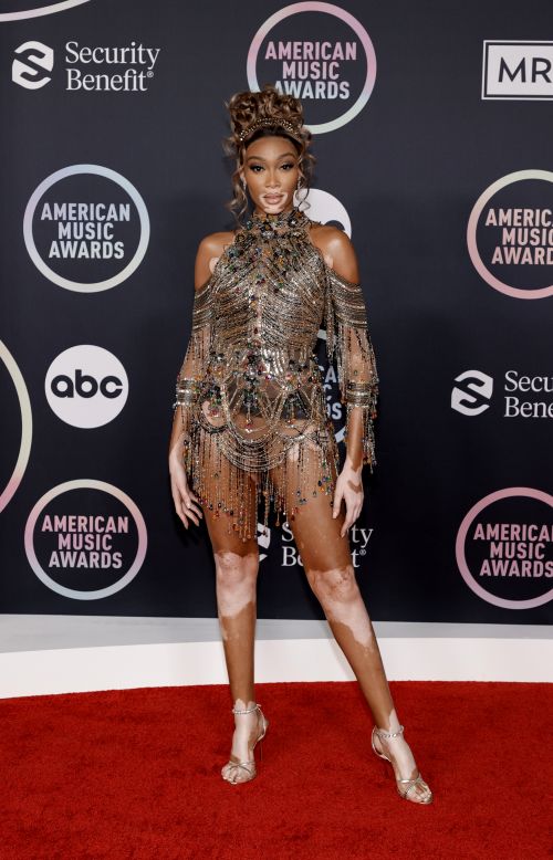 Winnie Harlow dared to bare in a fringed outfit by Zuhair Murad, adorned with metallic chains and vibrant teardrop-shaped beads. Harlow shared an early preview of her outfit on Instagram, sharing she was "red carpet ready" as she knelt in golden stilettos.