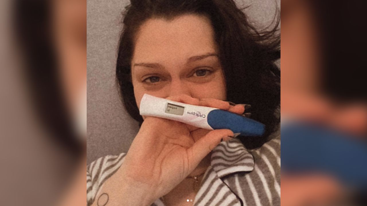 Jessie J revealed her pregnancy loss on Instagram. 