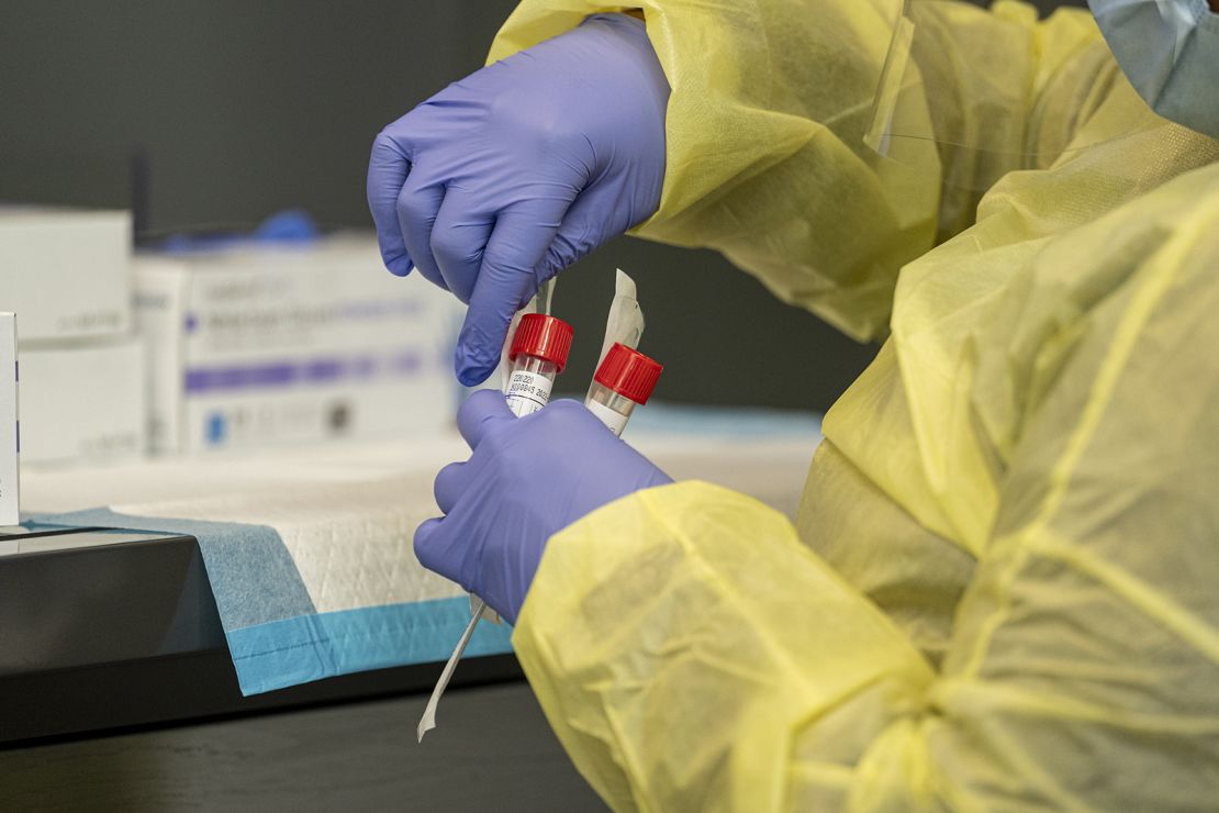 A medical worker seals a test tube with a Covid-19 nasal swab at the Dignity Health-GoHealth Urgent Care testing site in the international terminal at San Francisco International Airport in California, on December 2, 2021. 