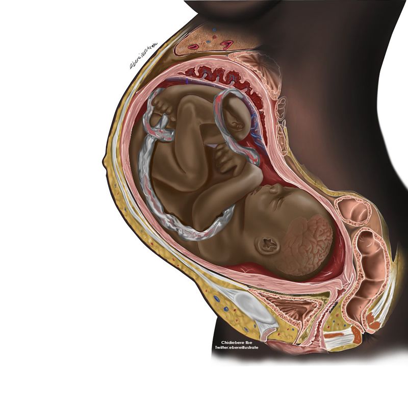 A viral image of a Black fetus is highlighting the need for diversity in medical illustrations pic