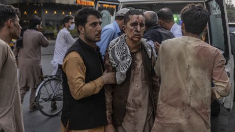 A person wounded in the ISIS bombing attack outside Kabul airport on August 26, 2021.