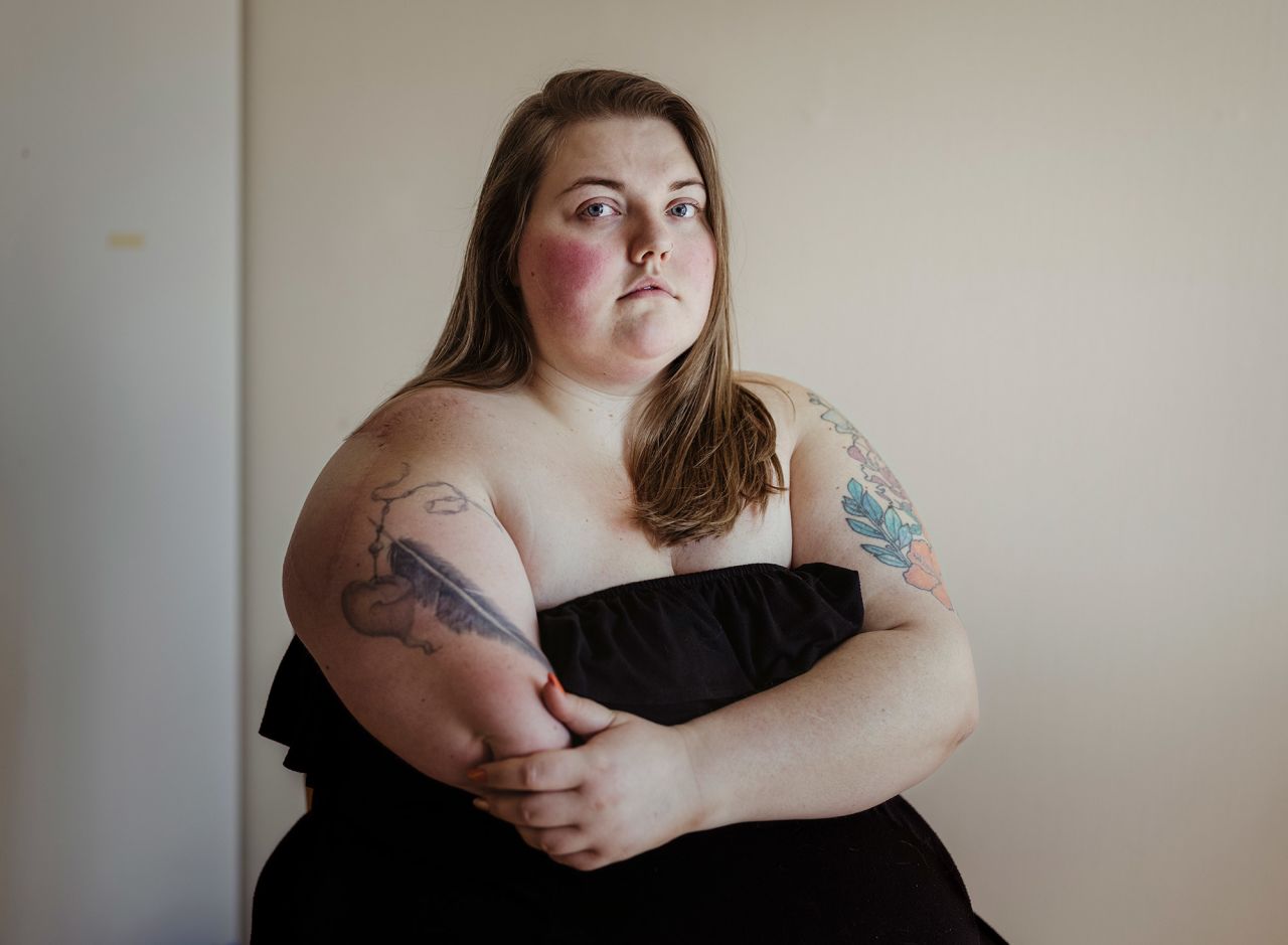 <strong>Andrea Gjestvang, based in Berlin, Germany:</strong> Cecilie, 26, from Sarpsborg, Norway, sits for a portrait in her home. She attended the summer camp on the Norwegian island of Utøya 10 years ago, where 69 young people were killed [in a terror attack]. Cecilie had to have her arm amputated due to a gunshot wound. Today she is unable to work after the injuries she suffered on Utøya.<br /> <br />Cecilie is both very vulnerable and extremely strong and that tension is interesting to me. She lost her arm, but she celebrates her body by tattooing it. She is one of the bravest young women I have ever photographed.<br /> <br />I first met Cecilie in 2012 when I was doing a portrait project about the young survivors of the July 22 attack on Utøya. I had not seen her since then and it's wonderful to see how she has coped and who she has become. The world freezes in the photos we take and sometimes we forget that life goes on.