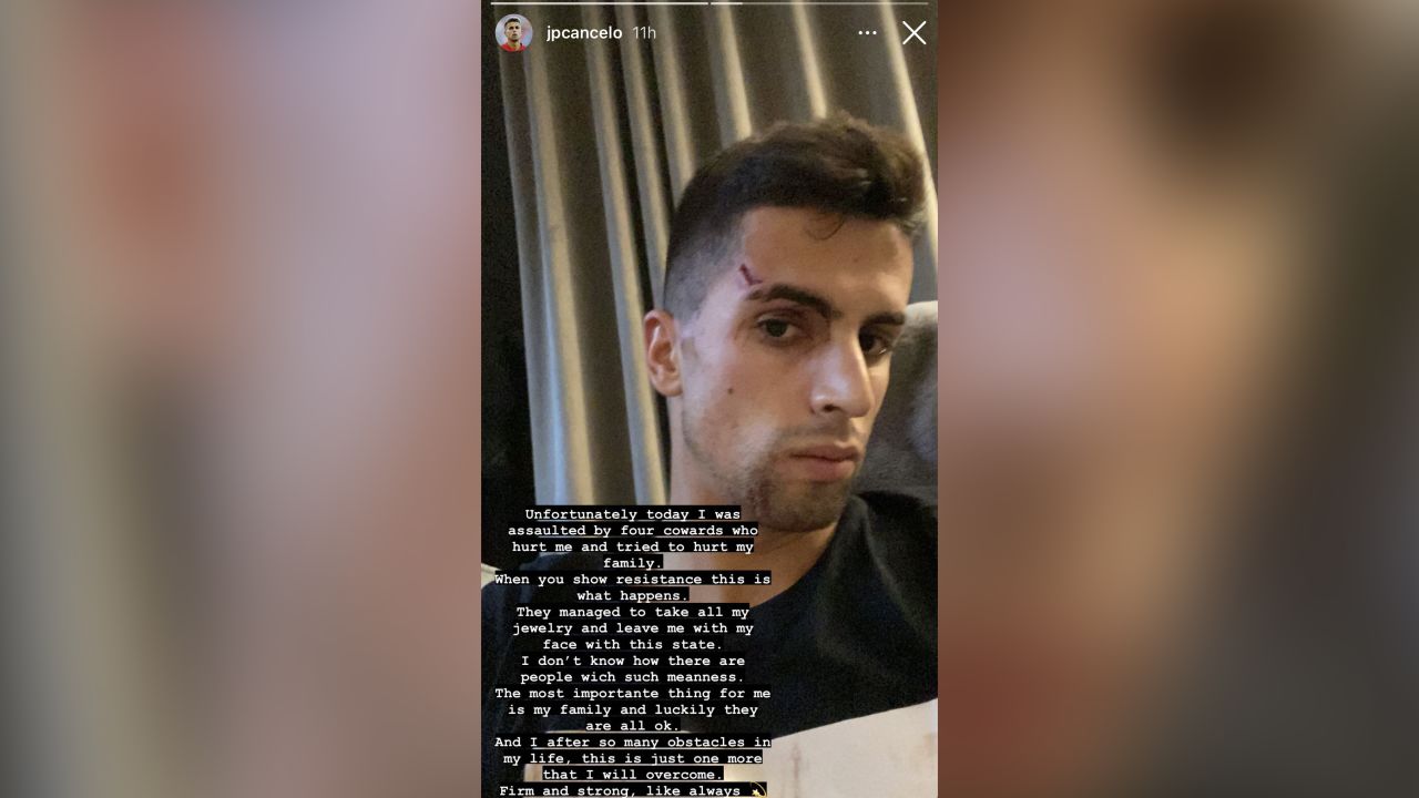 João Cancelo posted a picture of himself on his Instagram account with a cut above and bruising around his right eye.
