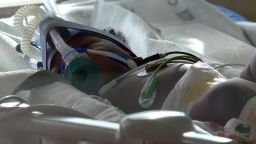 01 Texas childrens hospital Covid surge