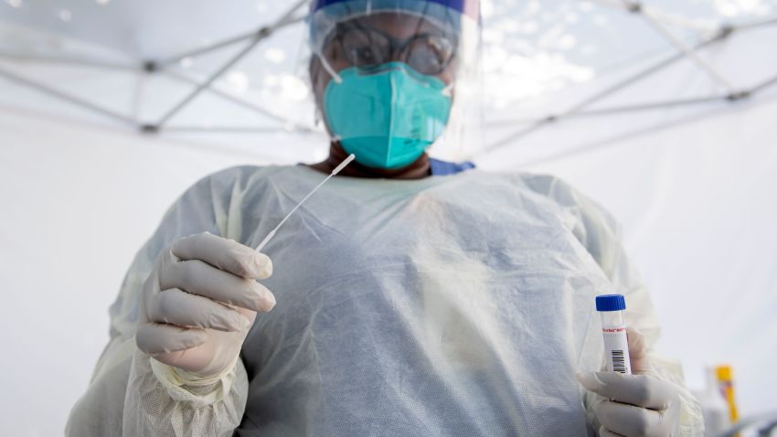 TOPSHOT - A health worker takes a nasal swab sample at a COVID-19 testing site at St. John's Well Child and Family Center, amid the novel coronavirus pandemic, July 24, 2020, in Los Angeles, California. - The coronavirus pandemic hit grim new milestones July 23, with cases topping four million in the United States and three million in Europe as fresh spikes from Belgium to Tokyo to Melbourne forced new restrictions on citizens. (Photo by VALERIE MACON / AFP) (Photo by VALERIE MACON/AFP via Getty Images)