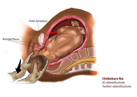 Ibe plans to become a pediatric neurosurgeon and is working on a textbook about birth defects in children. He says they will all be illustrated in Black skin.