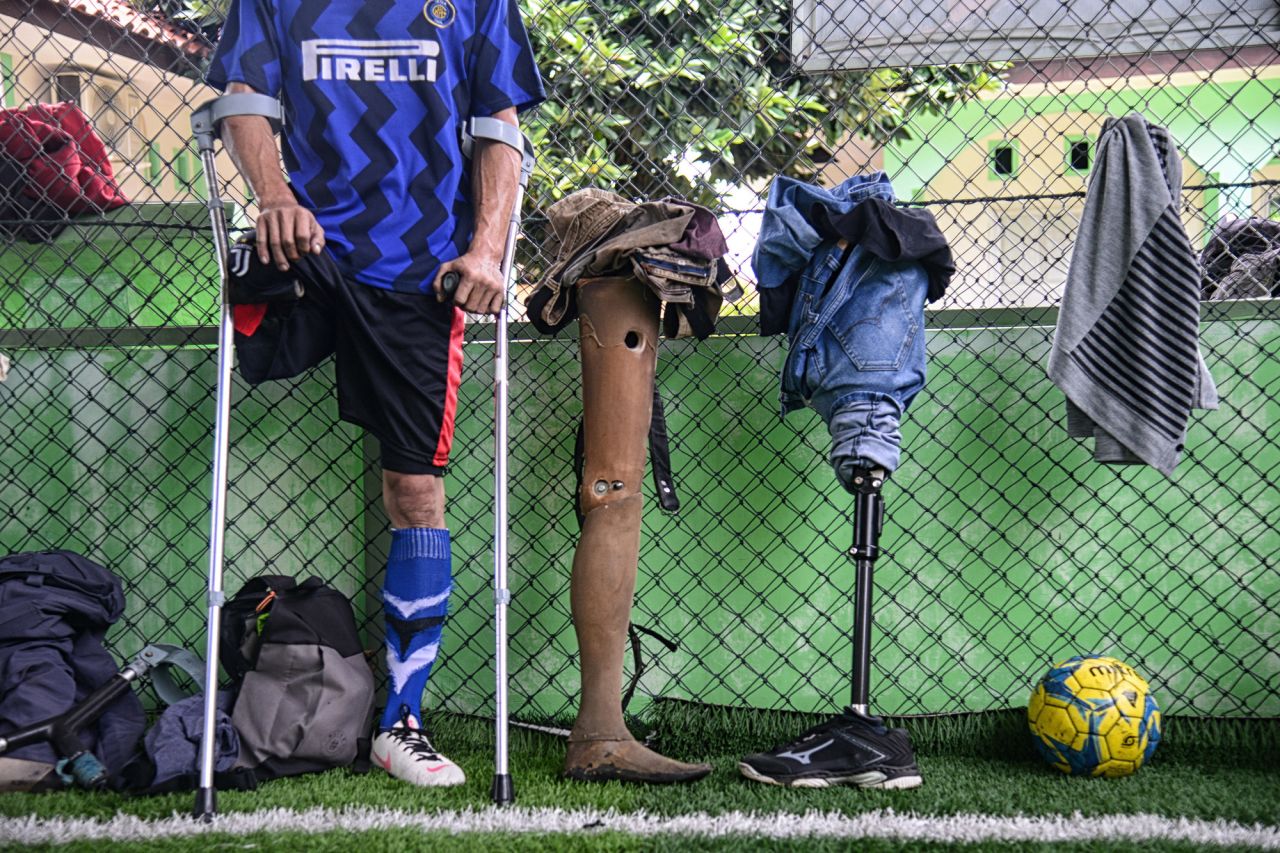 A player with the Asprov West Java amputee football team takes a break during training in Bogor, Indonesia, on Sunday, January 9.